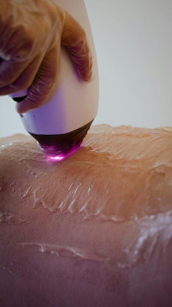 A gloved person uses a handheld device emitting purple light on a gel-covered skin surface, possibly for therapeutic or cosmetic treatment.