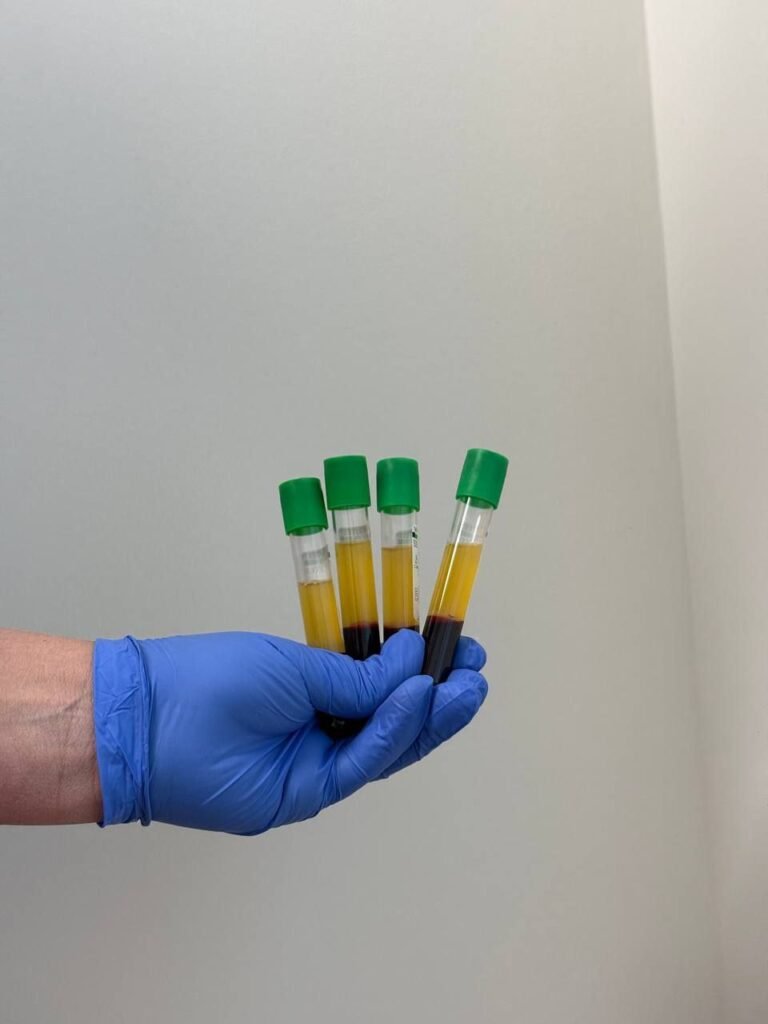 A person wearing blue gloves holds four blood sample tubes with green caps against a plain background.